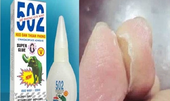 Hướng dẫn tẩy keo 502 bám trên đồ gỗ, dính tay, quần áo, đồ da...